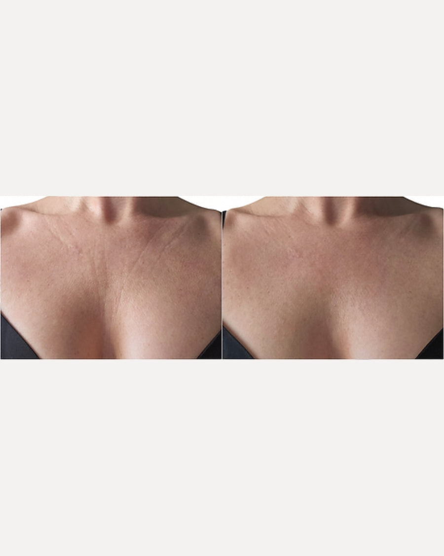 LULL & LUXE - Bye Bye Wrinkles Chest Pad